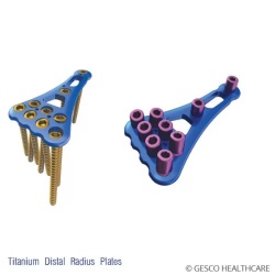 Fracture Plates and Screws Opulence locking plate system 